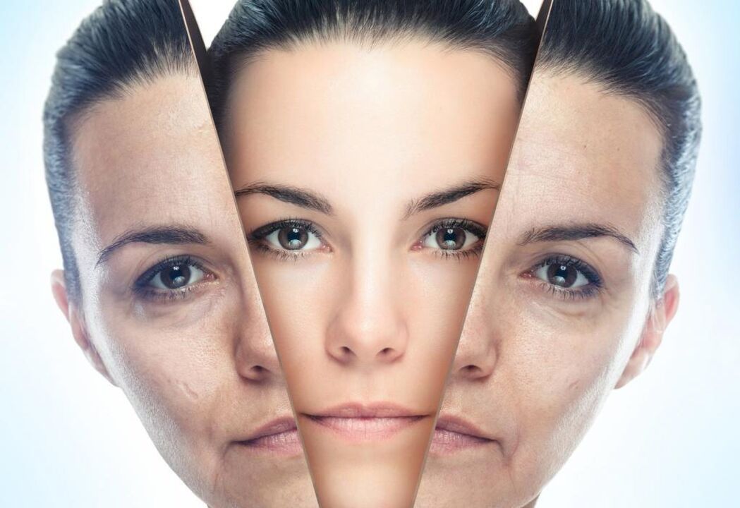 méthodes de rajeunissement du visage