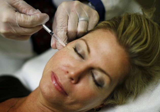 L'introduction de charges dans la peau du visage - une méthode d'injection de resserrement