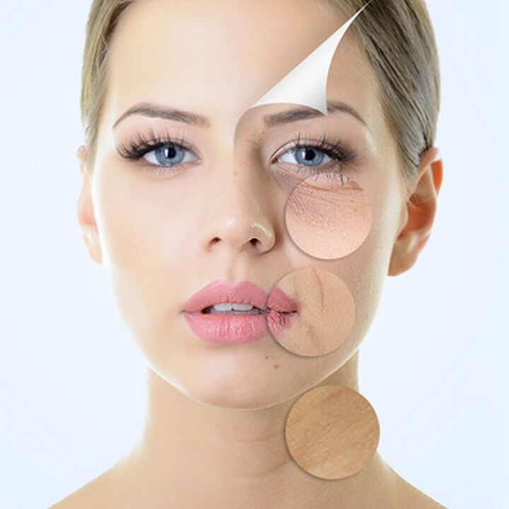 Imperfections de la peau du visage - indications des procédures anti-âge