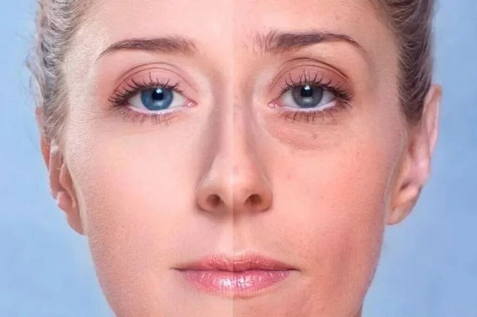 Dos sous les yeux